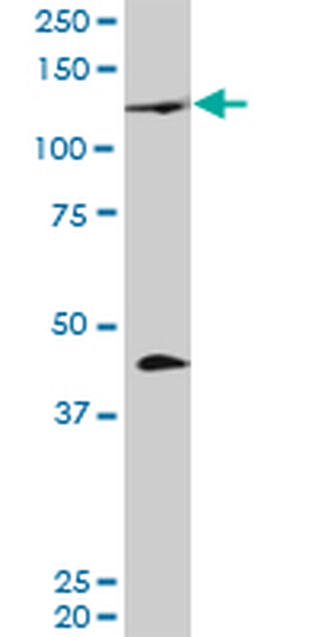 PRDM1 Antibody in Western Blot (WB)