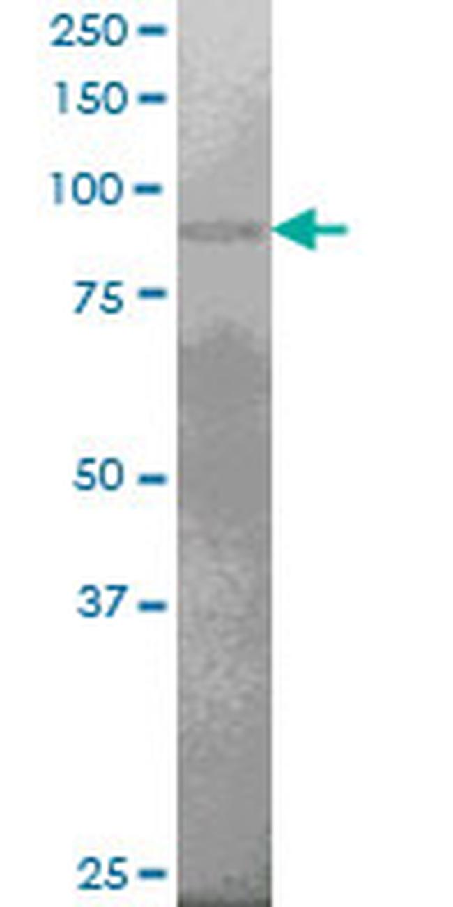 PRDM1 Antibody in Western Blot (WB)