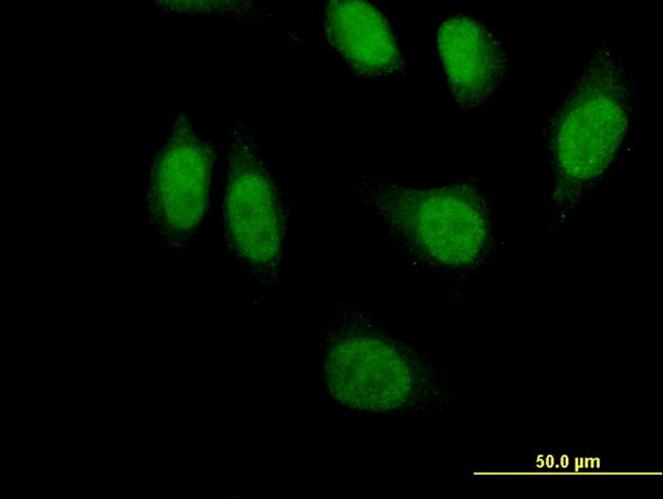 PRDM1 Antibody in Immunocytochemistry (ICC/IF)