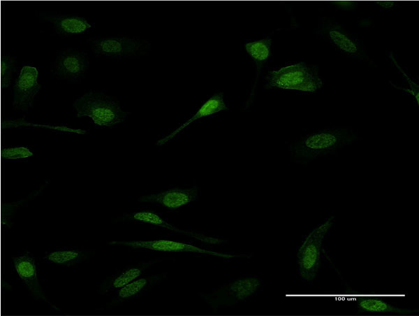 PRDM1 Antibody in Immunocytochemistry (ICC/IF)