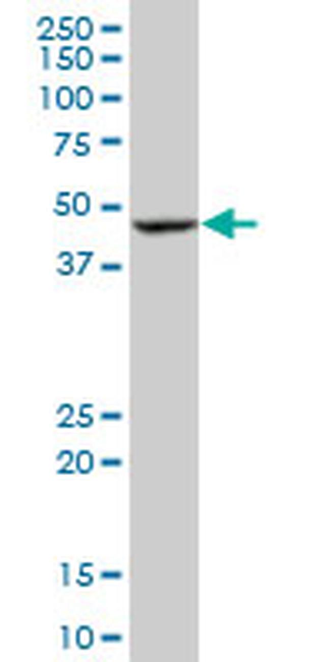 BLMH Antibody in Western Blot (WB)