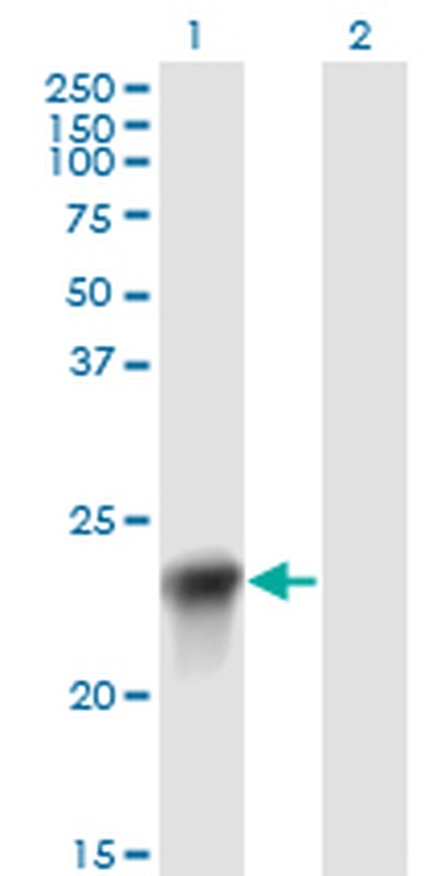 BLVRB Antibody in Western Blot (WB)