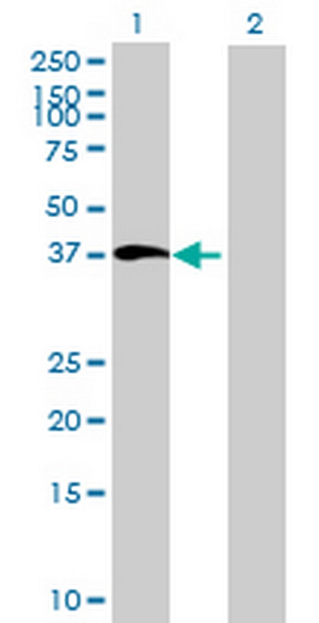 BMP5 Antibody in Western Blot (WB)