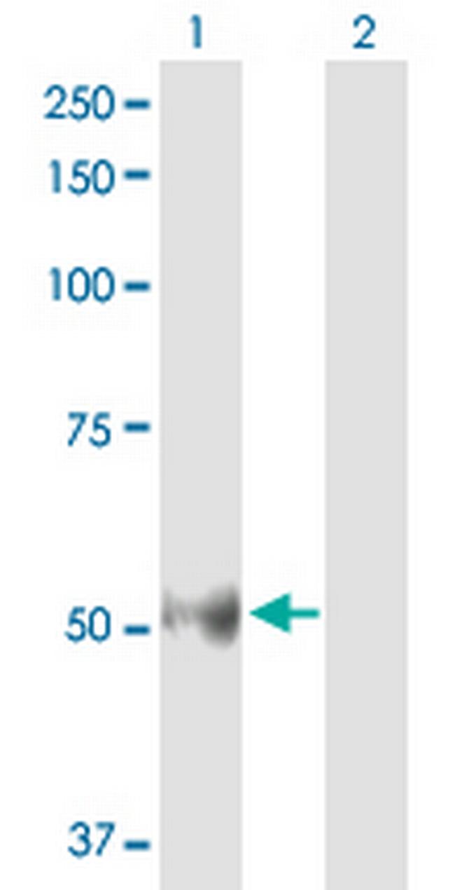 BMP5 Antibody in Western Blot (WB)