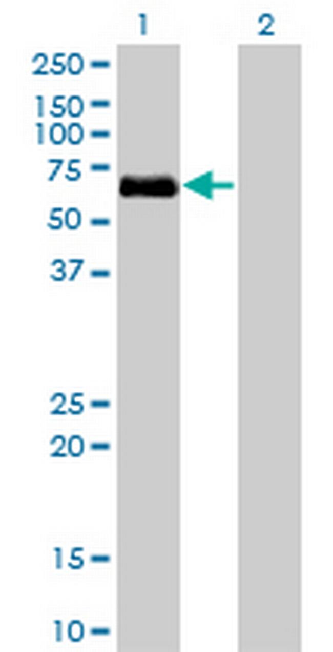BMPR1A Antibody in Western Blot (WB)