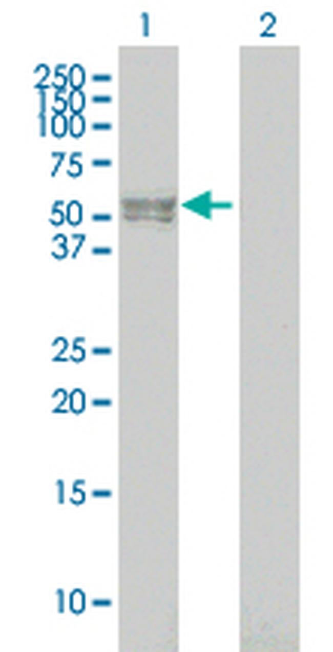 BMPR1B Antibody in Western Blot (WB)