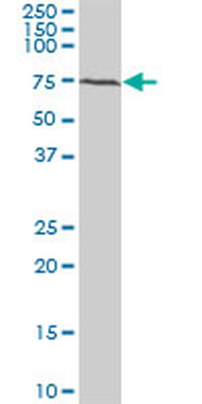 BMPR1B Antibody in Western Blot (WB)