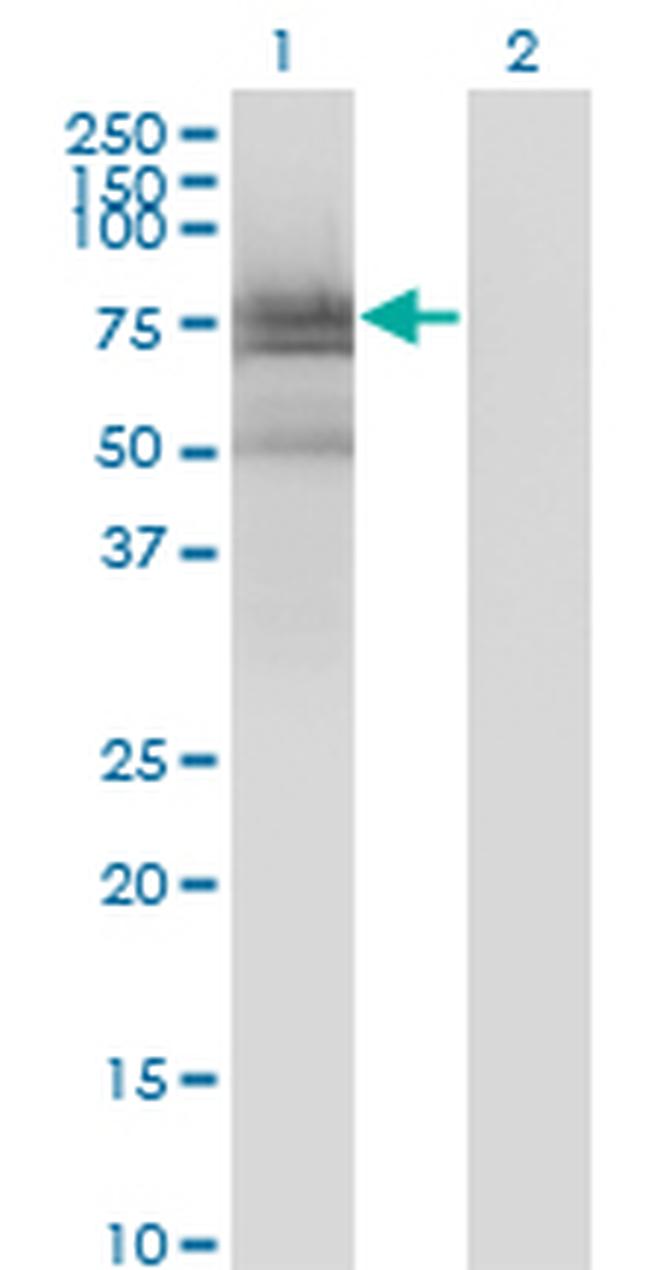 BMX Antibody in Western Blot (WB)