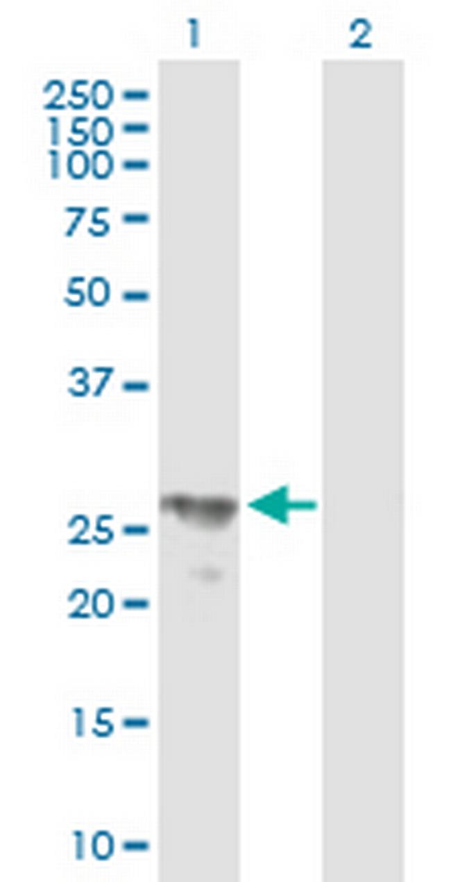 BPHL Antibody in Western Blot (WB)