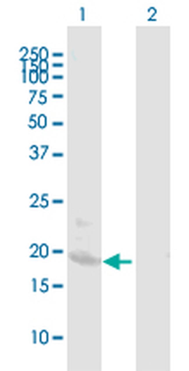 BST2 Antibody in Western Blot (WB)