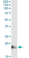 BST2 Antibody in Immunoprecipitation (IP)