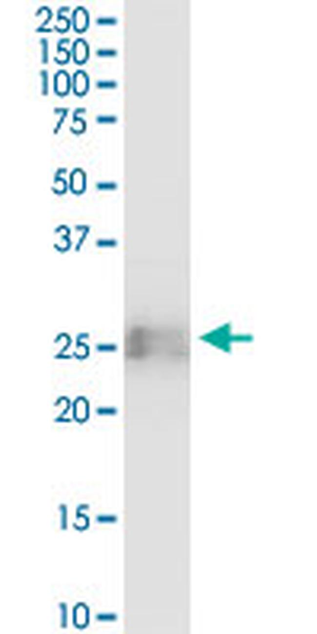 BST2 Antibody in Western Blot (WB)