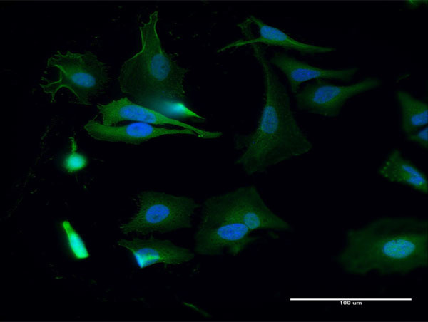 BUB1 Antibody in Immunocytochemistry (ICC/IF)