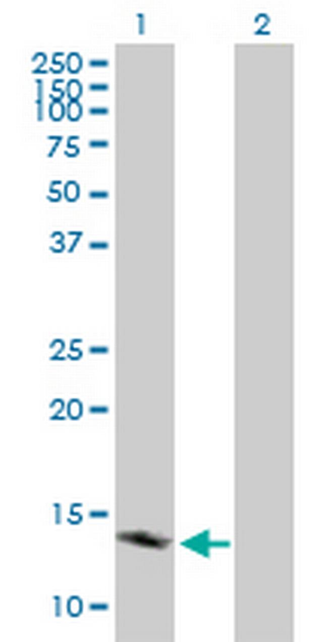 TSPO Antibody in Western Blot (WB)