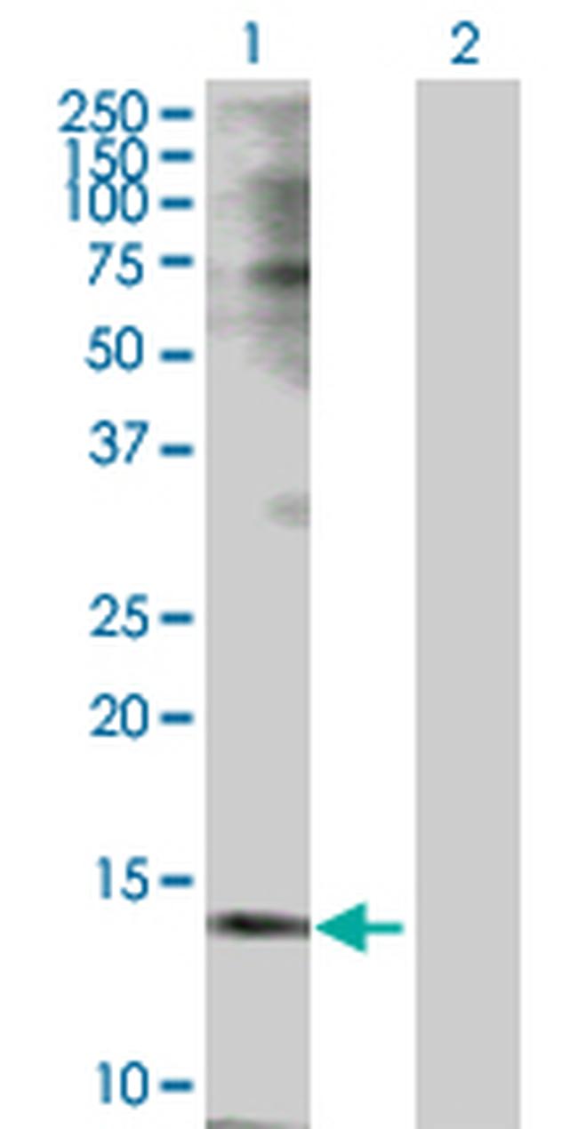 TSPO Antibody in Western Blot (WB)