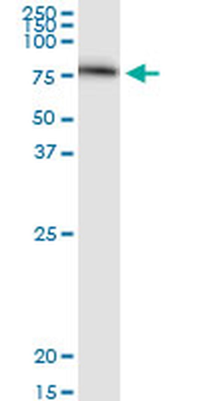 SERPING1 Antibody in Western Blot (WB)