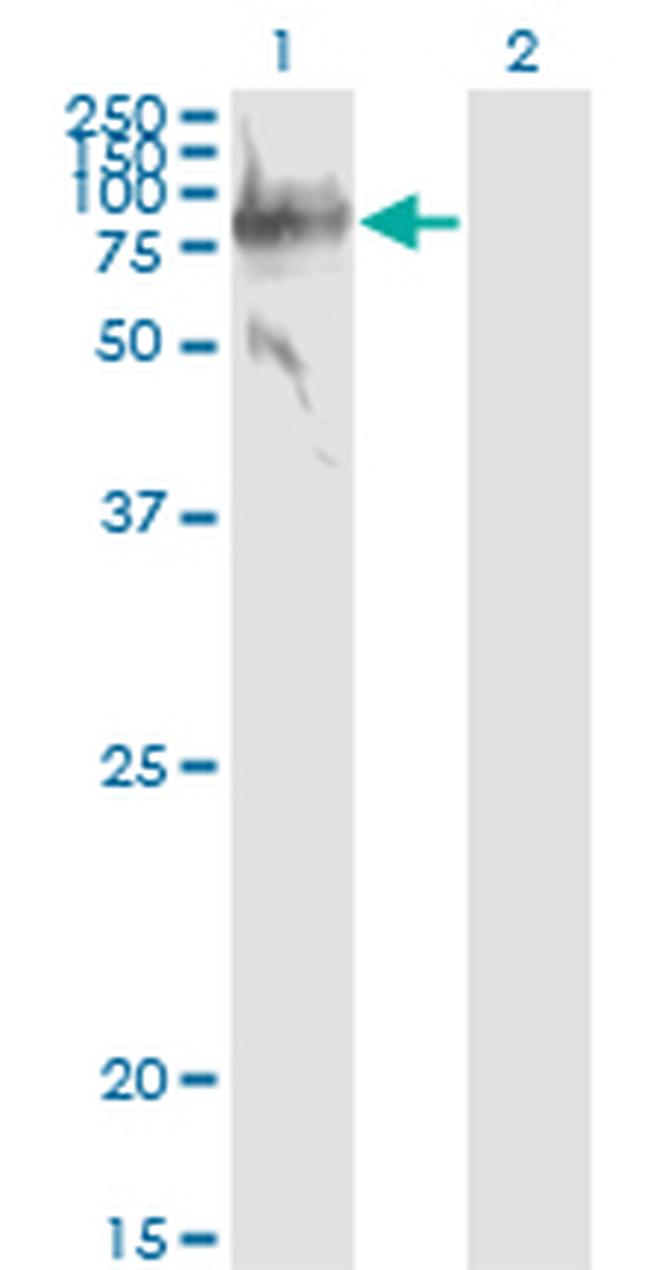 SERPING1 Antibody in Western Blot (WB)