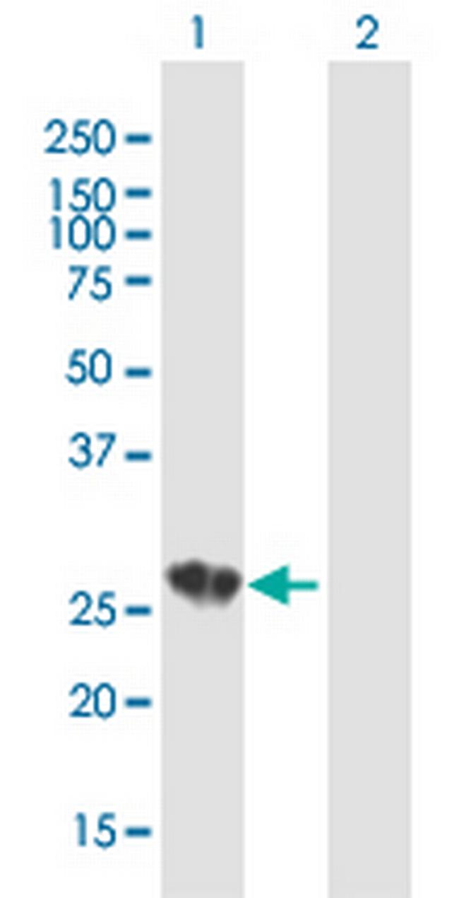 C1QA Antibody in Western Blot (WB)