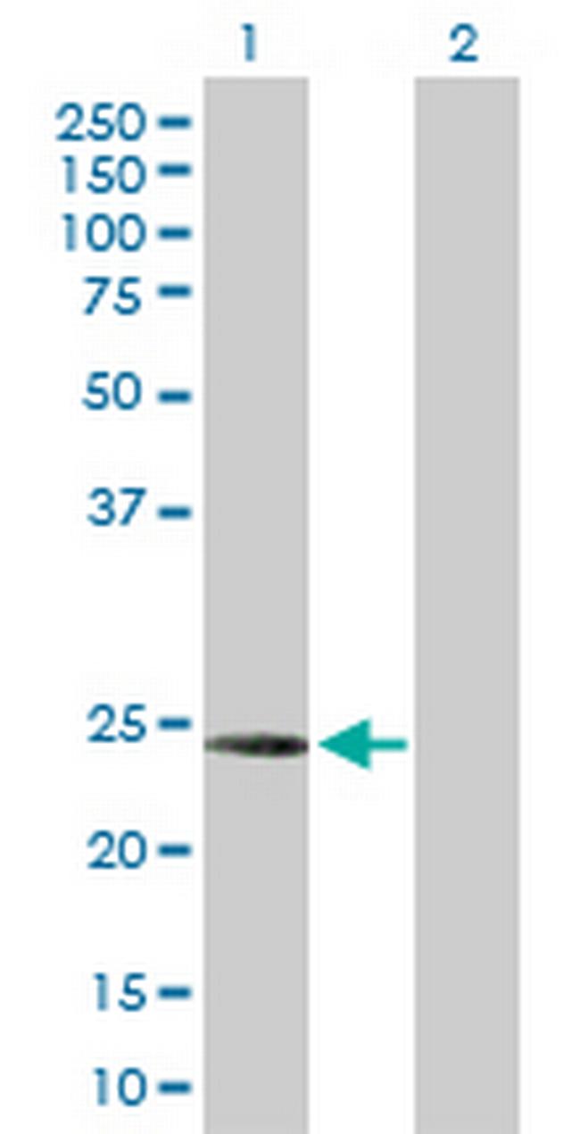 C1QC Antibody in Western Blot (WB)