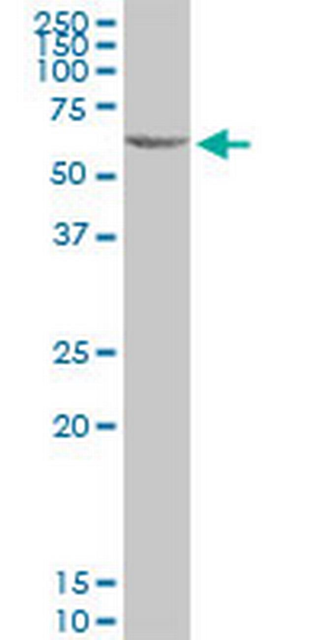 C3AR1 Antibody in Western Blot (WB)