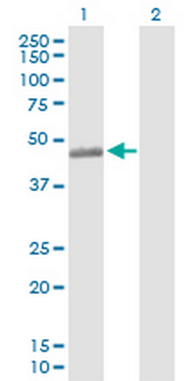 C3AR1 Antibody in Western Blot (WB)