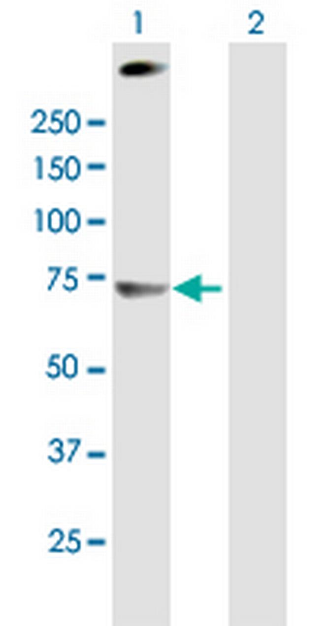 C4BPA Antibody in Western Blot (WB)