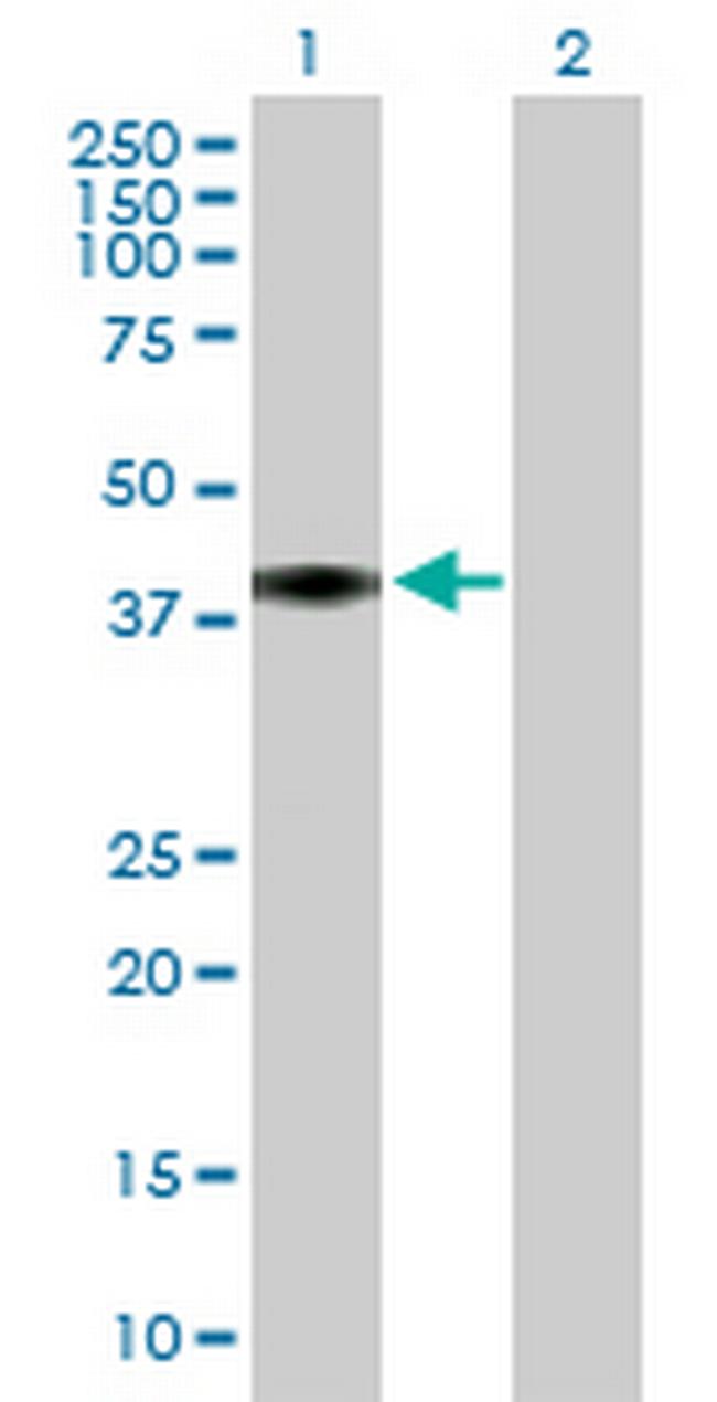 C4BPB Antibody in Western Blot (WB)