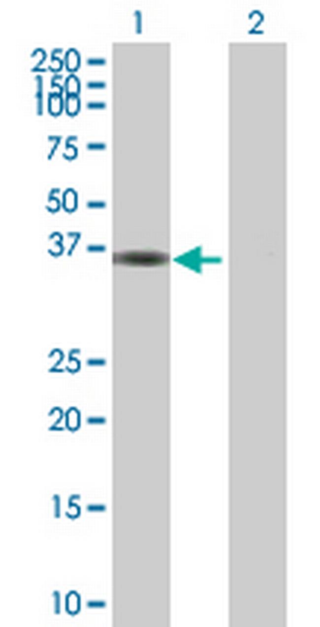 MPPED1 Antibody in Western Blot (WB)