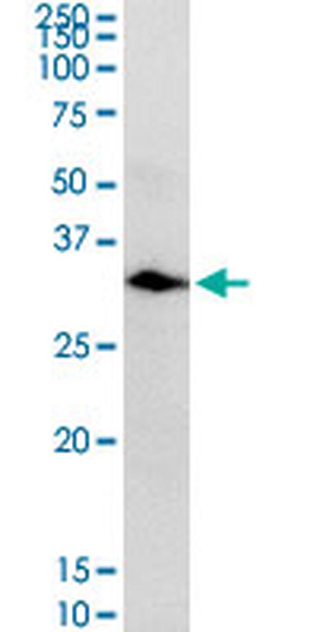 CA1 Antibody in Western Blot (WB)