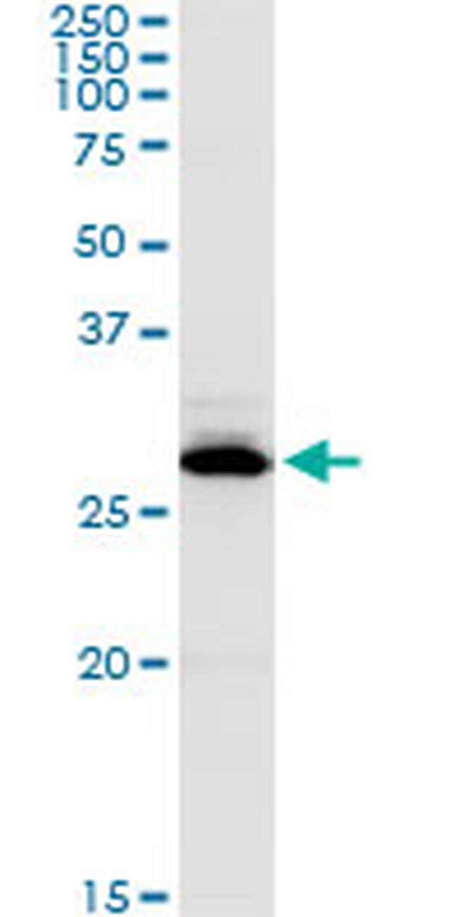 CA1 Antibody in Western Blot (WB)