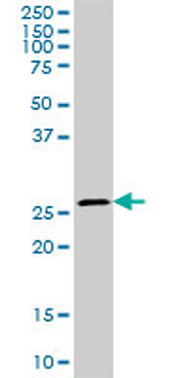 CA1 Antibody in Western Blot (WB)