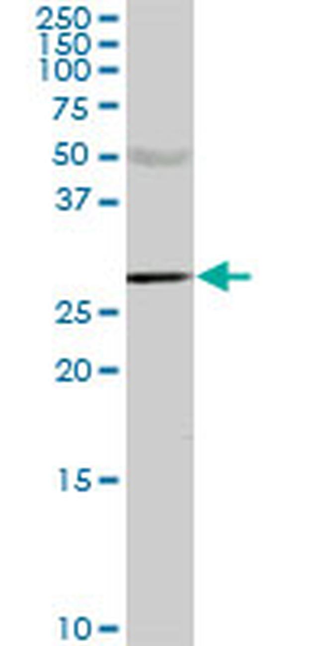 CA1 Antibody in Western Blot (WB)