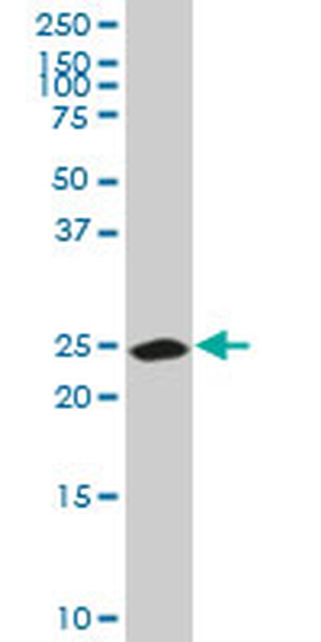 CA1 Antibody in Western Blot (WB)