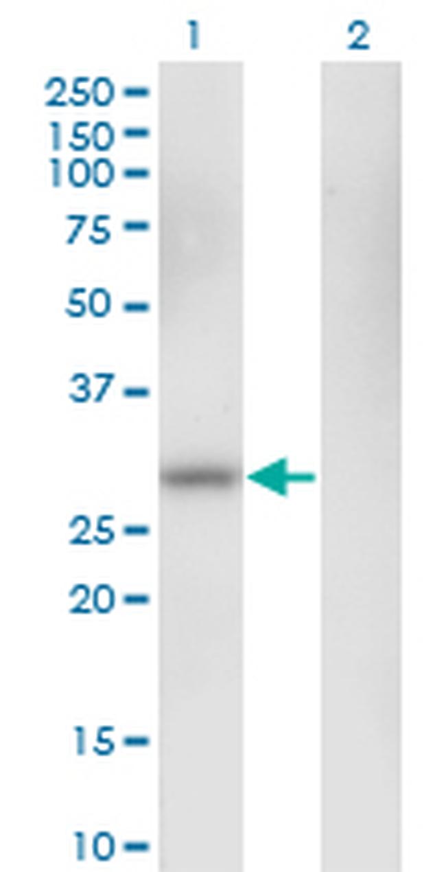 CA1 Antibody in Western Blot (WB)