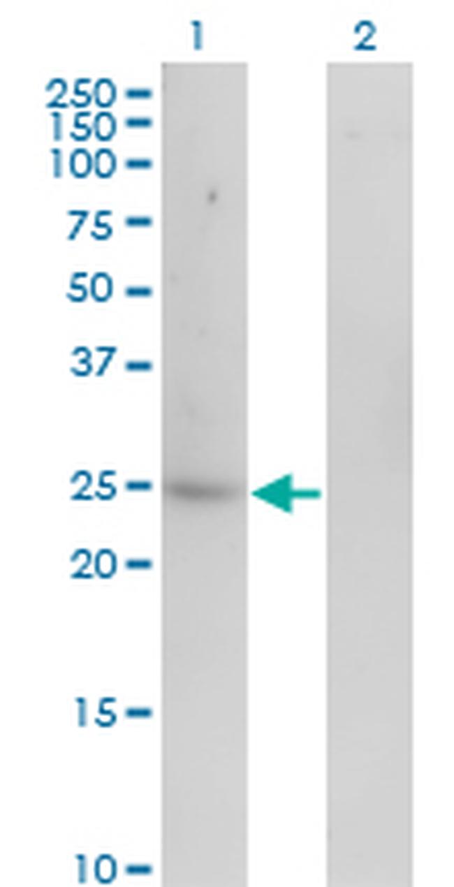 CA1 Antibody in Western Blot (WB)