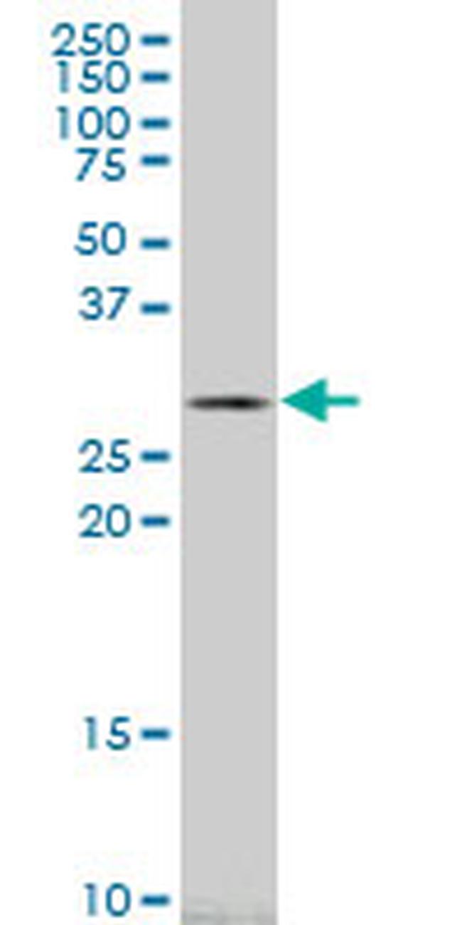 CA1 Antibody in Western Blot (WB)