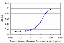 CA1 Antibody in ELISA (ELISA)