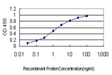 CACNB2 Antibody in ELISA (ELISA)