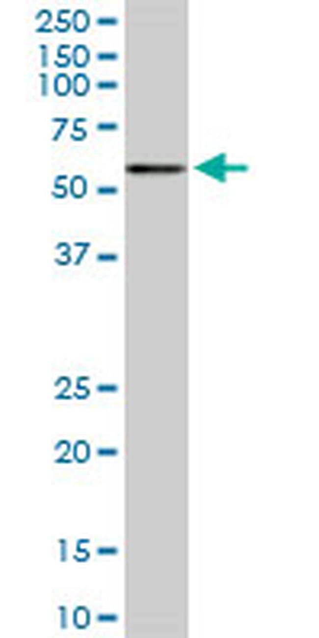 CACNB2 Antibody in Western Blot (WB)