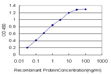 CACNB2 Antibody in ELISA (ELISA)