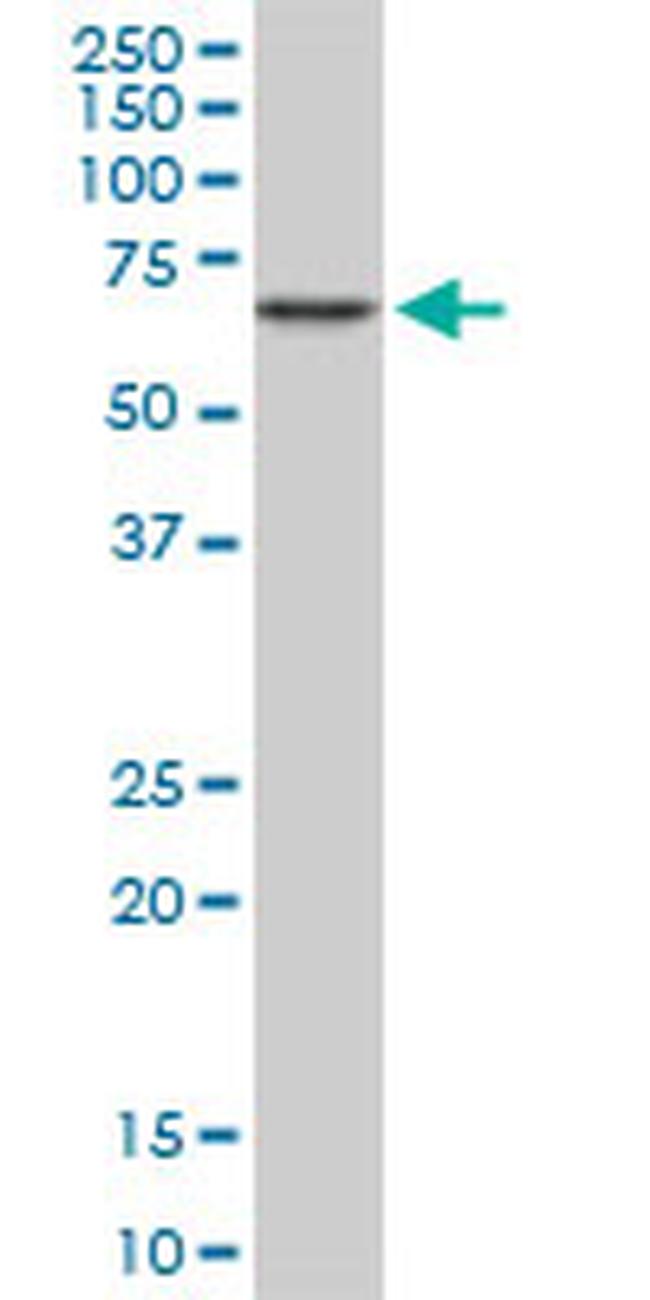 CACNB2 Antibody in Western Blot (WB)