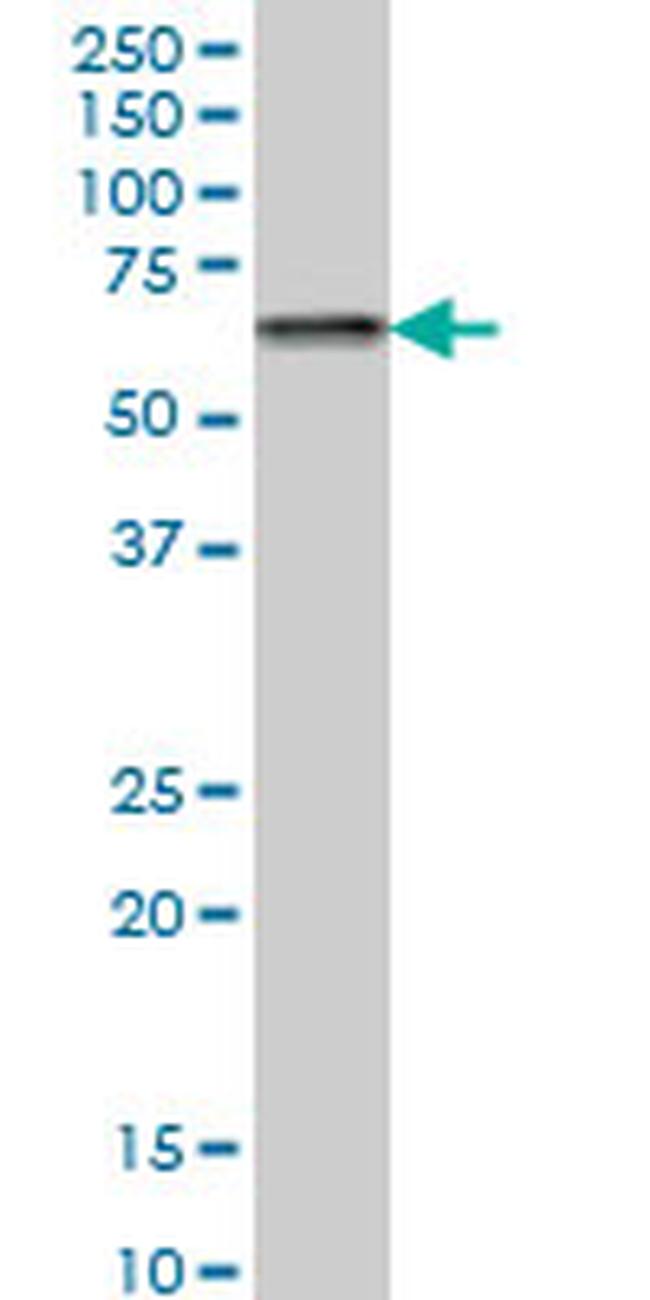 CACNB2 Antibody in Western Blot (WB)