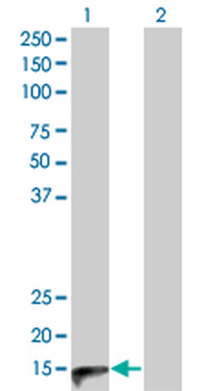 CALCA Antibody in Western Blot (WB)