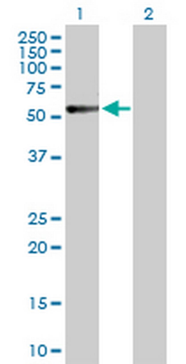 CALCR Antibody in Western Blot (WB)