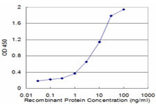 CALCR Antibody in ELISA (ELISA)