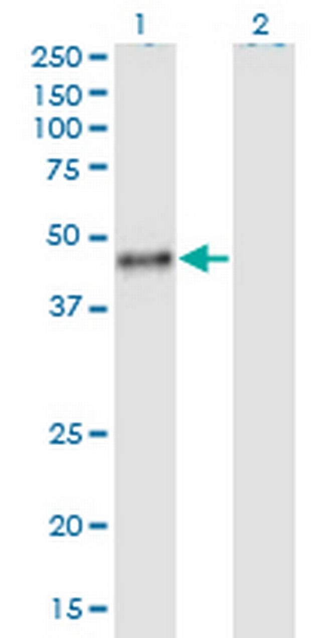 CALU Antibody in Western Blot (WB)