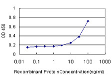 CAMK2A Antibody in ELISA (ELISA)