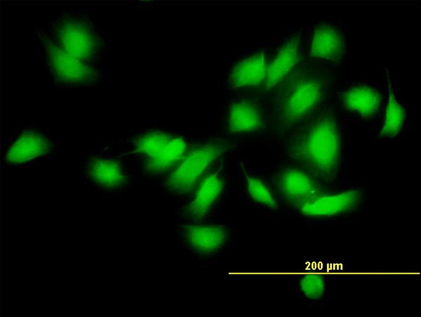 CAMK2A Antibody in Immunocytochemistry (ICC/IF)