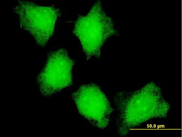 CAMK2A Antibody in Immunocytochemistry (ICC/IF)