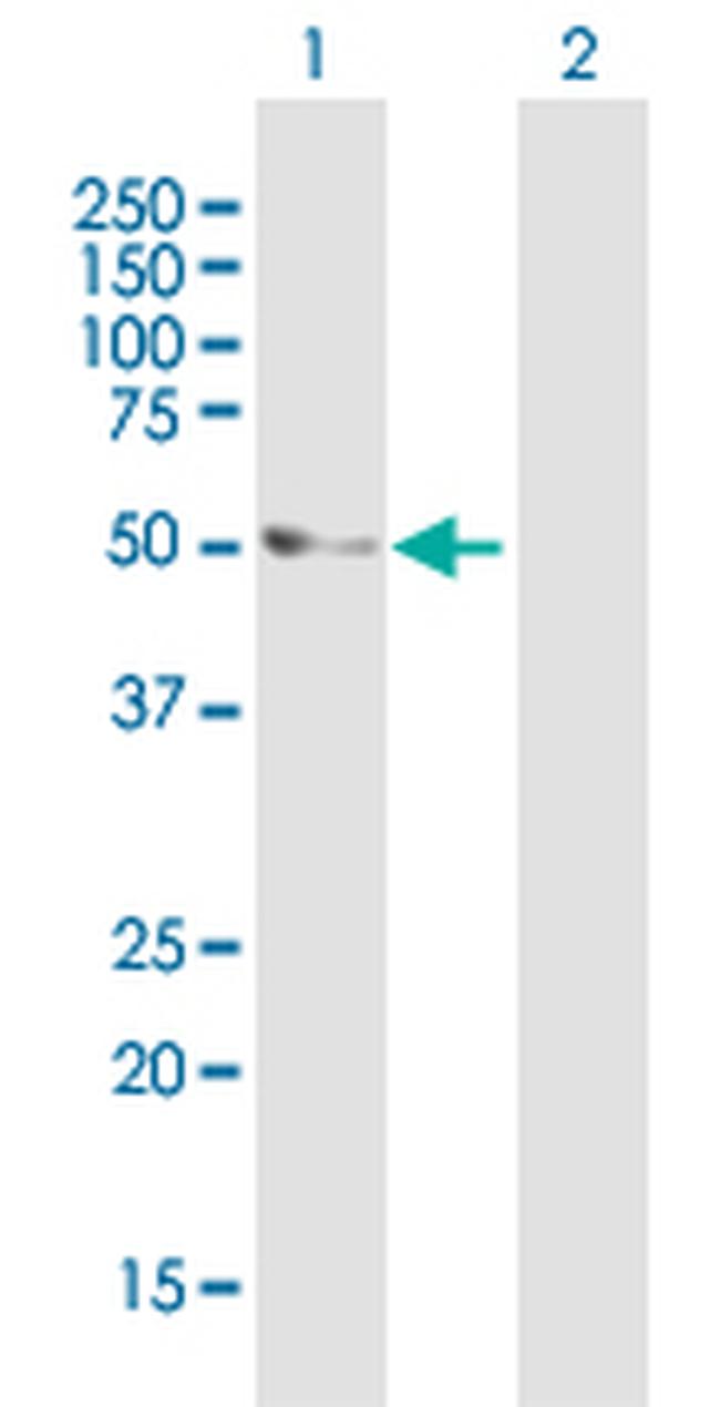 CAMK2B Antibody in Western Blot (WB)